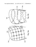 Methods for reducing hydrostatic organ pressure diagram and image