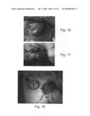 Methods for reducing hydrostatic organ pressure diagram and image