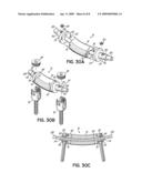 Pre-Curved Flexible Member For Providing Dynamic Stability To A Spine diagram and image