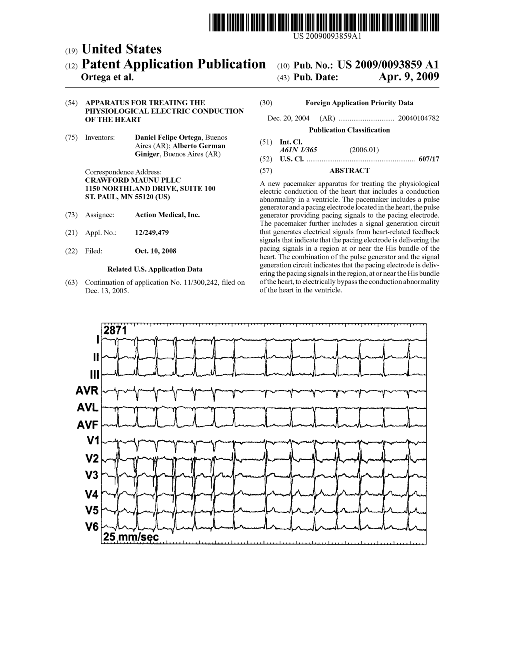 APPARATUS FOR TREATING THE PHYSIOLOGICAL ELECTRIC CONDUCTION OF THE HEART - diagram, schematic, and image 01