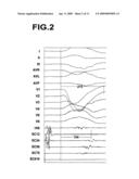 APPARATUS FOR TREATING THE PHYSIOLOGICAL ELECTRIC CONDUCTION OF THE HEART diagram and image