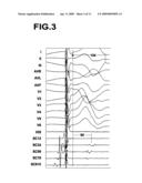 APPARATUS FOR TREATING THE PHYSIOLOGICAL ELECTRIC CONDUCTION OF THE HEART diagram and image