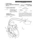 AUTOMATIC DETERMINATION OF T-SHOCK VULNERABLE WINDOW diagram and image