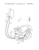 AUTOMATIC DETERMINATION OF T-SHOCK VULNERABLE WINDOW diagram and image