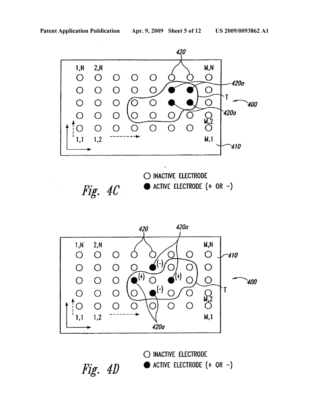 Systems and Methods for Automatically Optimizing Stimulus Parameters and Electrode configurations for neuro-stimulators - diagram, schematic, and image 06