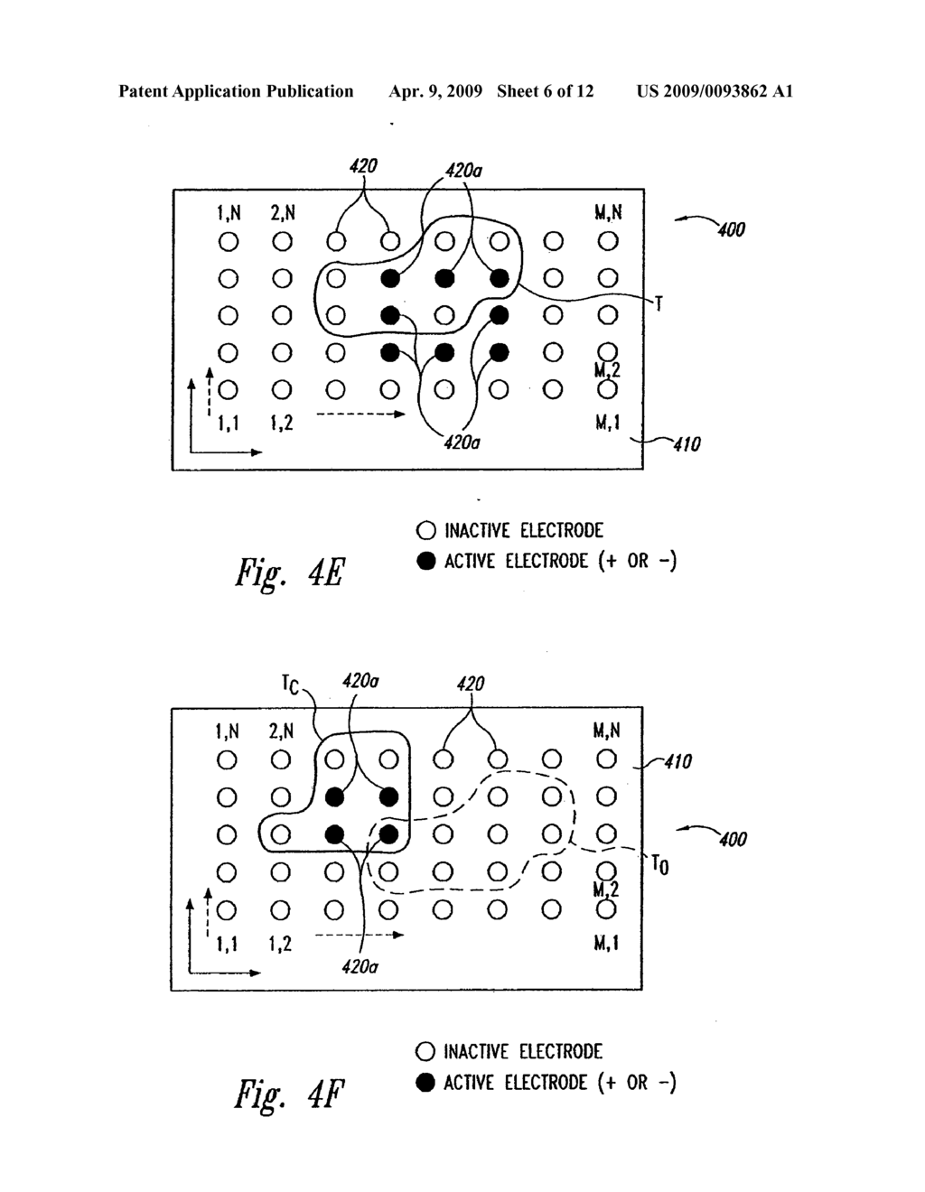 Systems and Methods for Automatically Optimizing Stimulus Parameters and Electrode configurations for neuro-stimulators - diagram, schematic, and image 07