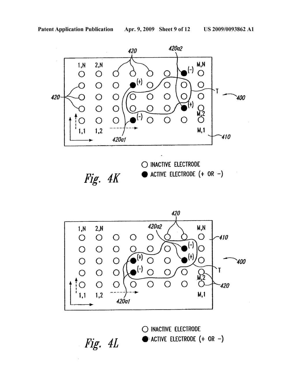 Systems and Methods for Automatically Optimizing Stimulus Parameters and Electrode configurations for neuro-stimulators - diagram, schematic, and image 10