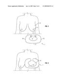 Support Pillow for Breastfeeding diagram and image