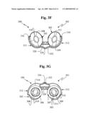 Nasal prongs diagram and image