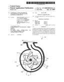 Composite Casting Method of Wear-Resistant Abrasive Fluid Handling Components diagram and image