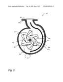 Composite Casting Method of Wear-Resistant Abrasive Fluid Handling Components diagram and image