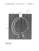 Composite Casting Method of Wear-Resistant Abrasive Fluid Handling Components diagram and image