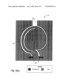 Composite Casting Method of Wear-Resistant Abrasive Fluid Handling Components diagram and image