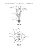 SYSTEMS AND METHODS FOR REDUCING BACKWARD WHIRLING WHILE DRILLING diagram and image