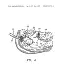 HUB FOR POSITIONING ANNULAR STRUCTURE ON A SURGICAL DEVICE diagram and image