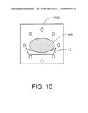 X-RAY CT APPARATUS AND METHOD FOR PROCESSING X-RAY PROJECTION DATA diagram and image