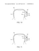 METHODS AND APPARATUS FOR TRANSMITTING VIBRATIONS diagram and image