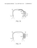 METHODS AND APPARATUS FOR TRANSMITTING VIBRATIONS diagram and image