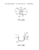 METHODS AND APPARATUS FOR TRANSMITTING VIBRATIONS diagram and image