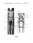 METHOD, SYSTEM AND SOFTWARE PRODUCT FOR PROVIDING EFFICIENT REGISTRATION OF VOLUMETRIC IMAGES diagram and image