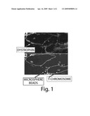 SKELETAL MUSCLE AUGMENTATION UTILIZING MUSCLE-DERIVED PROGENITOR COMPOSITIONS, AND TREATMENTS THEREOF diagram and image