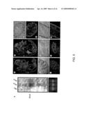 Hormonally up-regulated, neu-tumor-associated kinase diagram and image