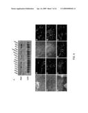 Hormonally up-regulated, neu-tumor-associated kinase diagram and image