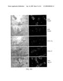 Hormonally up-regulated, neu-tumor-associated kinase diagram and image