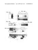 Hormonally up-regulated, neu-tumor-associated kinase diagram and image