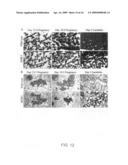 Hormonally up-regulated, neu-tumor-associated kinase diagram and image