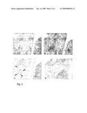 Method for Diagnosing Cardiovascular Diseases diagram and image