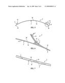 Composite Heat Shield diagram and image