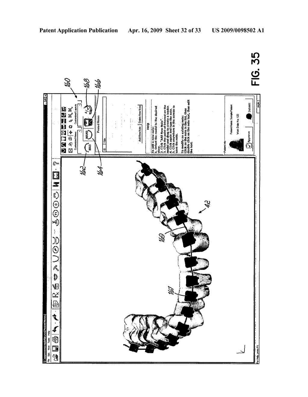 Software and Methods for Dental Treatment Planning - diagram, schematic, and image 33