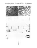 UPREGULATION OF RACK-1 IN MELANOMA AND ITS USE AS A MARKER diagram and image