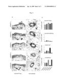 Method for subgroup analysis in subjects having or being suspected of having inflammatory disease, use of anti-p38MAPK antibodies, kits and their use diagram and image