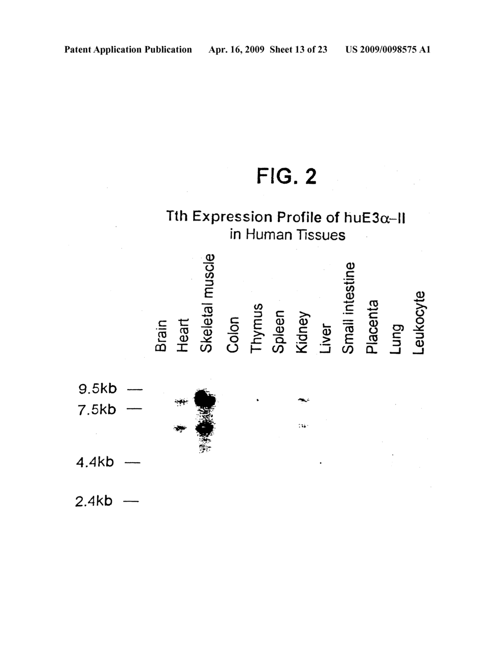 The Human E3alpha Ubiquitin Ligase Family - diagram, schematic, and image 14