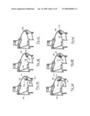 VENTILATION DEVICE diagram and image