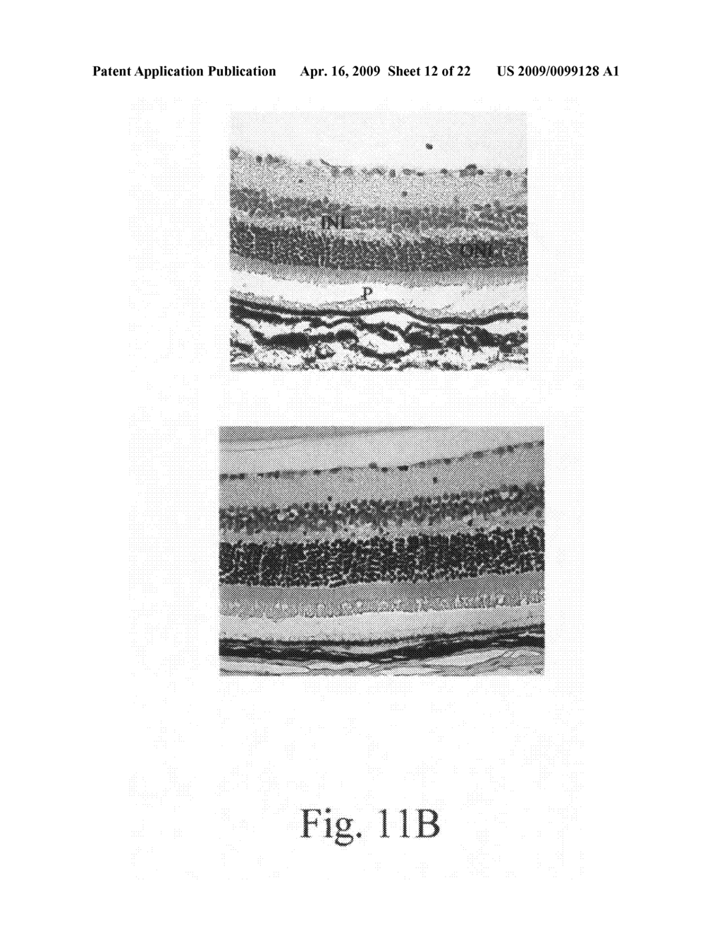 Composition and method for treating autoimmune disease and mucosal disorder - diagram, schematic, and image 13