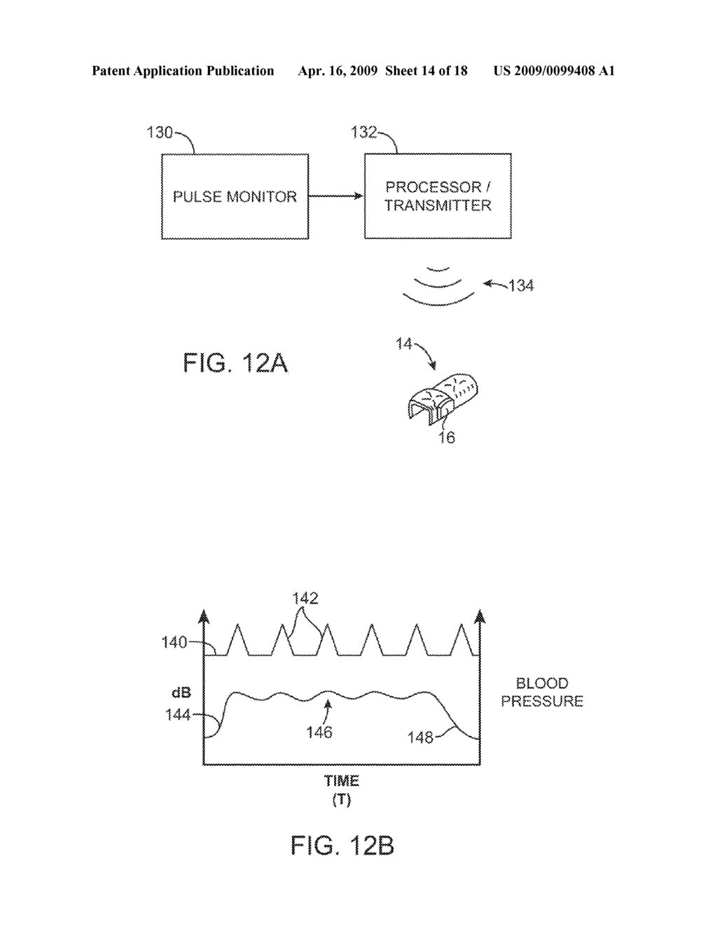 METHODS AND APPARATUS FOR TREATING TINNITUS - diagram, schematic, and image 15