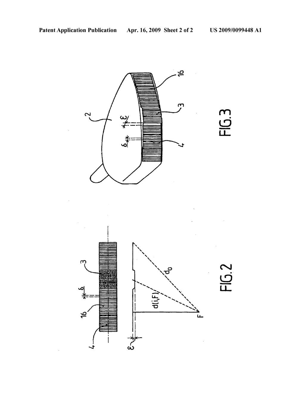 Human or animal organ imaging system which can be used to measure the elasticity of the organ - diagram, schematic, and image 03