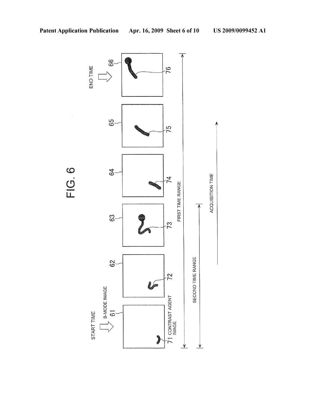 ULTRASONIC IMAGING APPARATUS - diagram, schematic, and image 07