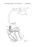 METHOD AND SYSTEM FOR TRACKING QUALITY OF LIFE IN PATIENTS WITH ANGINA diagram and image