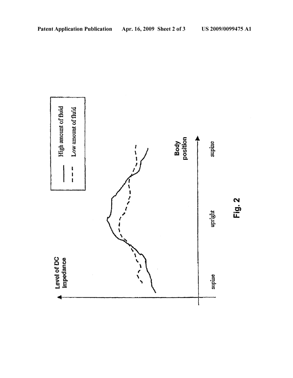 METHOD AND IMPLANTABLE MEDICAL DEVICE FOR ASSESSING A DEGREE OF PULMONARY EDEMA OF A PATIENT - diagram, schematic, and image 03