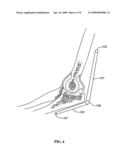 Devices, Systems and Methods for Measuring and Evaluating the Motion and Function of Joints and Associated Muscles diagram and image