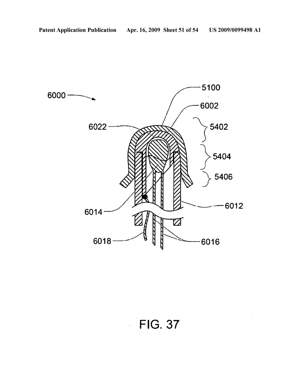 Systems, Devices and Methods for Cardiopulmonary Treatment and Procedures - diagram, schematic, and image 52