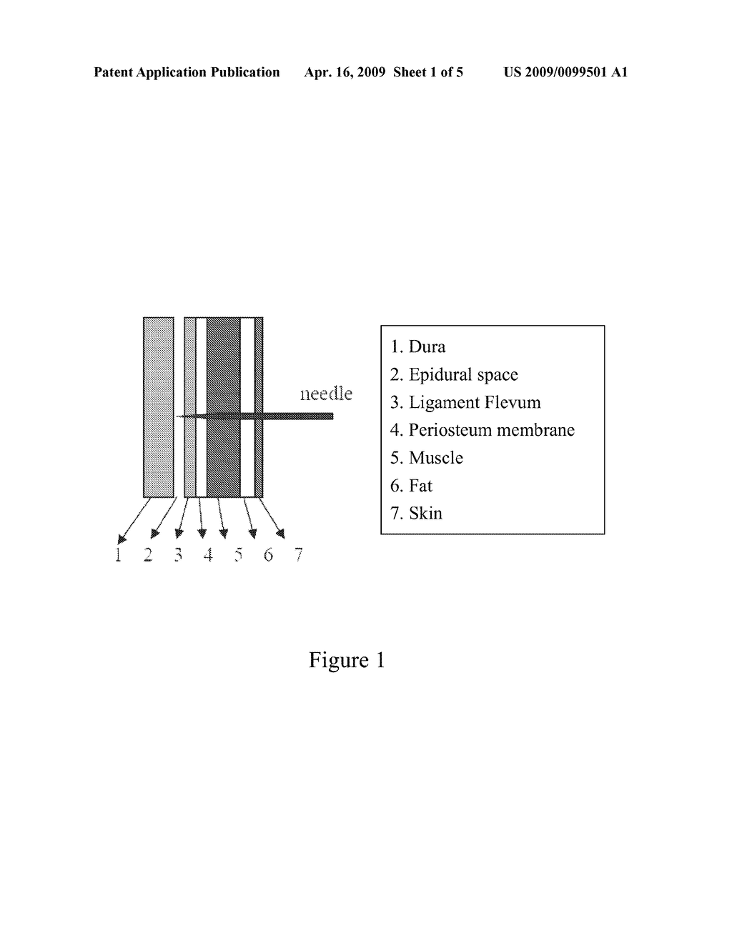 Spinal Cord's Epidural Space Detection By Using Fiber Optic Technology - diagram, schematic, and image 02