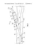 ANCHOR INSTRUMENTATION AND METHODS diagram and image