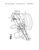 Intervertebral implant diagram and image