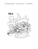 Intervertebral implant diagram and image