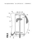 Intervertebral implant diagram and image